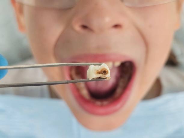 Best Emergency Pediatric Dental Care in Wichita, KS